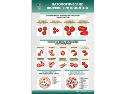 Стенд "Патологические формы эритроцитов"