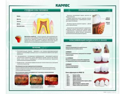 Стенд "Кариес"