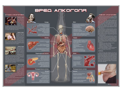 Стенд "Вред алкоголя"