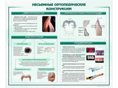 Стенд "Несъёмные ортопедические конструкции"