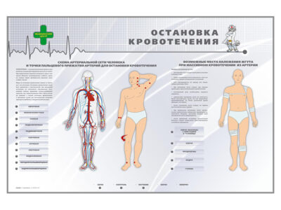 Электрофицированный стенд "Остановка кровотечения"