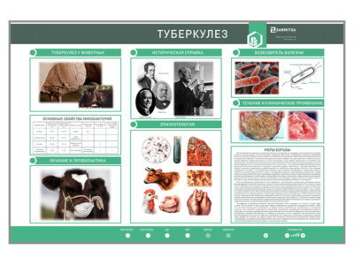 Электрифицированный стенд  «Туберкулез»