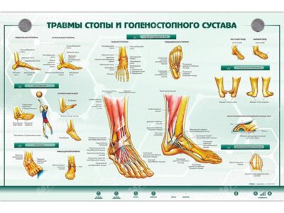 Интерактивный светодинамический стенд "Травмы стопы и голеностопного сустава"