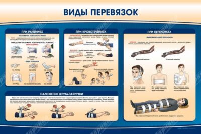 Стенд "Виды перевязок"