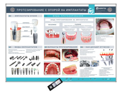 Интерактивный стенд "Протезирование с опорой на имплантаты"